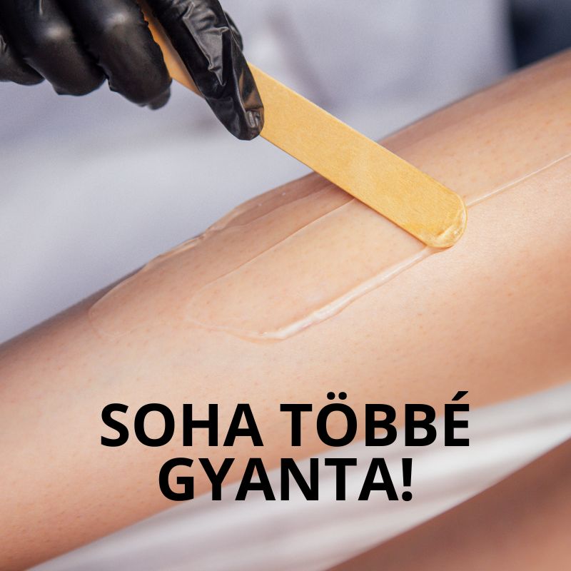 lézeres szőrtelenítés